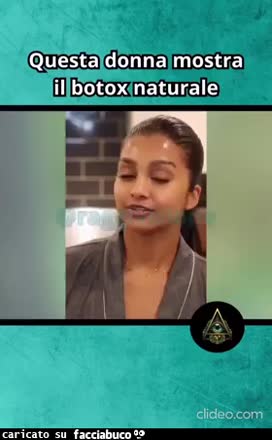 Questa donna mostra il botox naturale banana