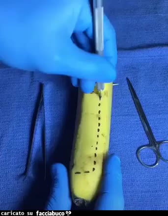 NASCITA DI UNA PICCOLA BANANA (taglio cesareo in diretta)